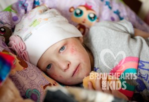 Childhood Neuroblastoma – Treatment