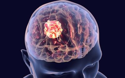 Discoveries point to a new potential treatment approach for fatal childhood brain tumor