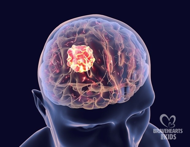 Discoveries point to a new potential treatment approach for fatal childhood brain tumor
